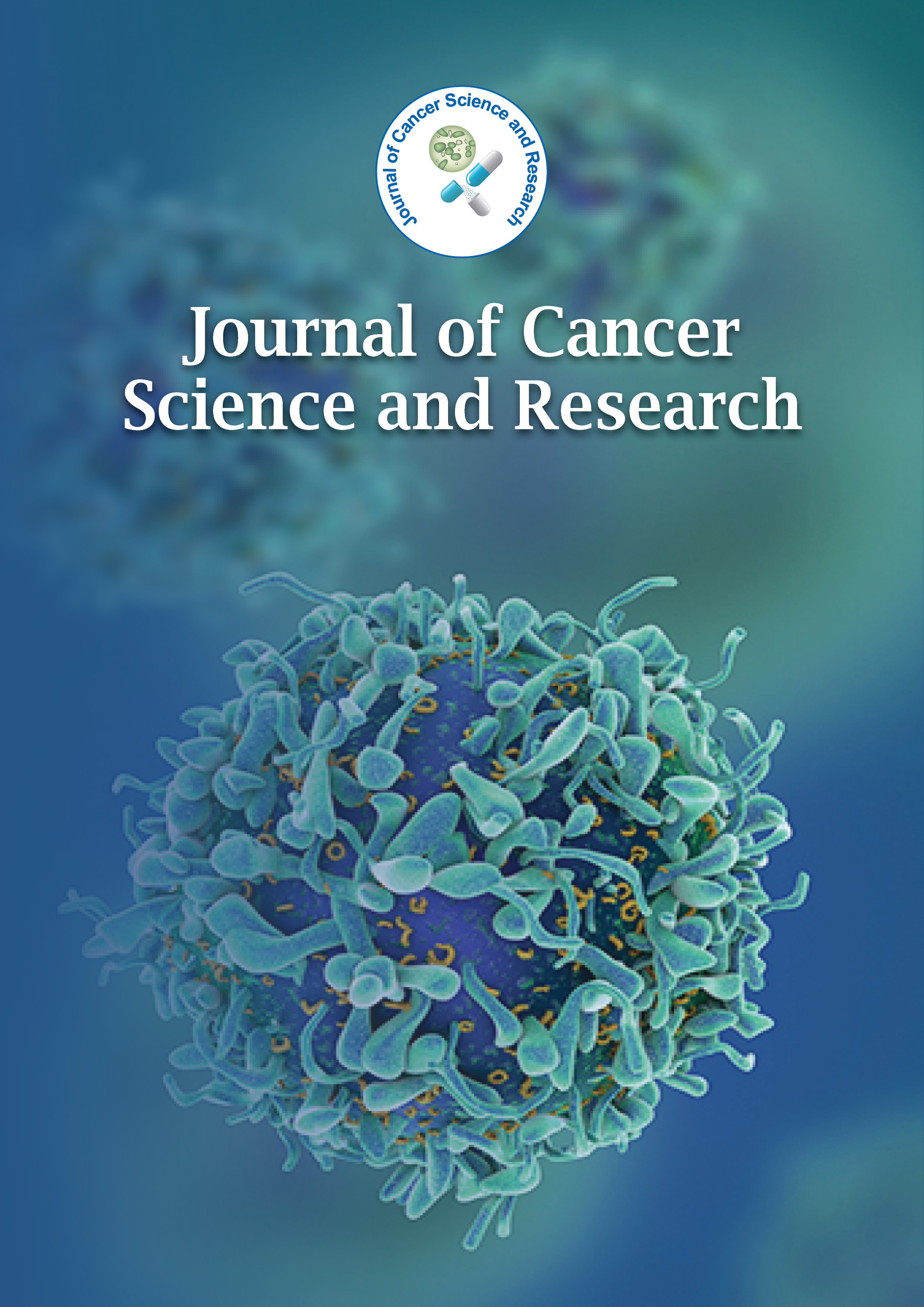 Medullary Carcinoma Of Colon Pathologists Dilemma