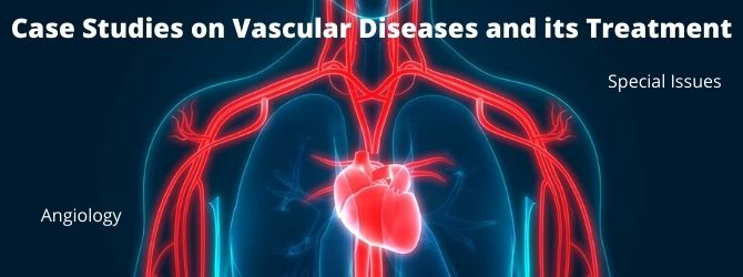 case-studies-on-vascular-diseases-and-its-treatment-1970.jpg