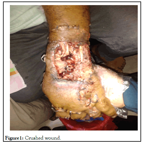 Clinical-Chemistry-wound