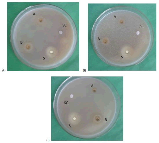 Journal-Nutrition-Food-Sciences-Aspergillus