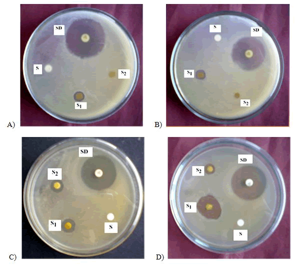 Journal-Nutrition-Food-Sciences-Bacillus