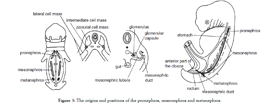 Kidney-mesonephros-metanephros