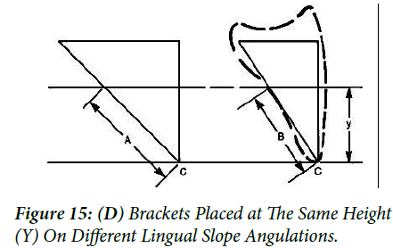Angulations
