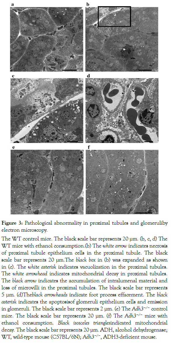 alcoholism-drug-dependence-tubules