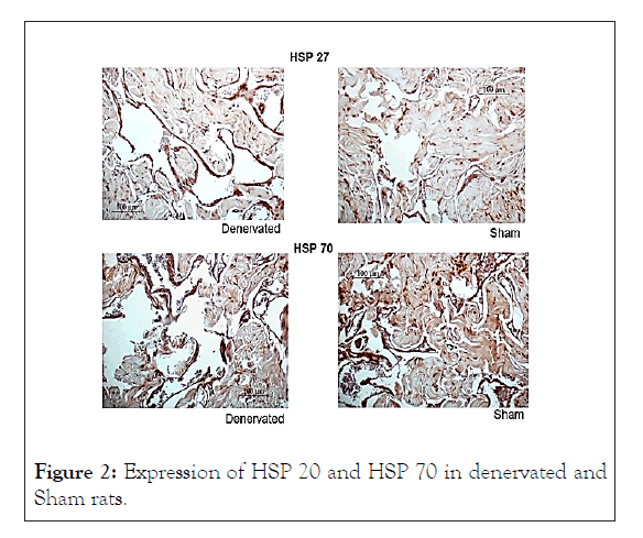 andrology-denervated