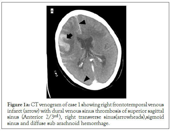 anesthesia-clinical-frontotemporal