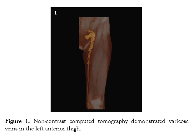 angiology-tomography