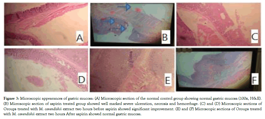 aromatic-plants-gastric-mucosa