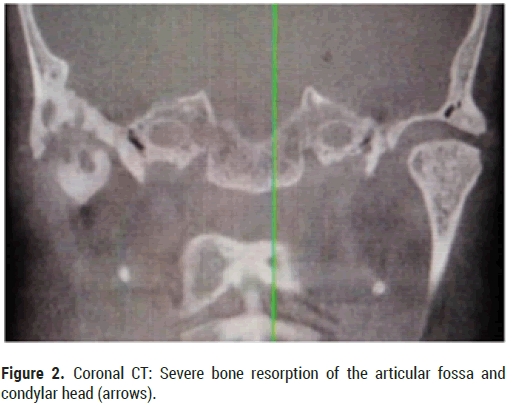 articular