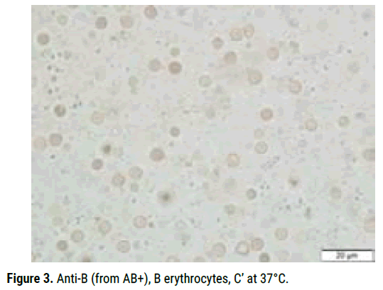 biology-todays-erythrocytes