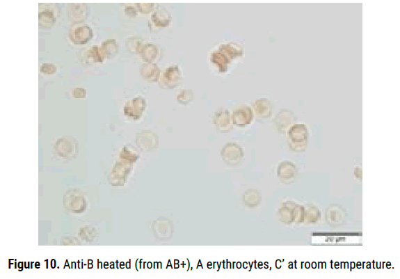 biology-todays-erythrocytes