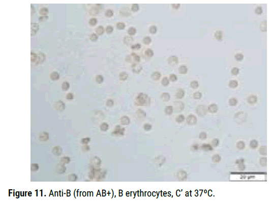 biology-todays-erythrocytes