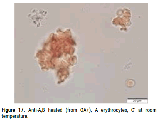 biology-todays-erythrocytes