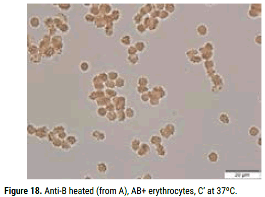 biology-todays-erythrocytes