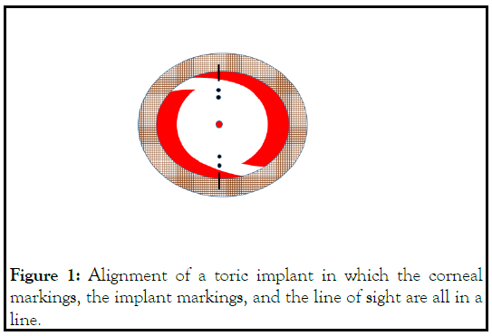 Alignment