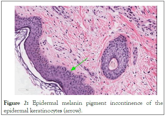 Epidermal