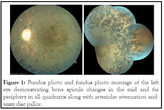 Fundus