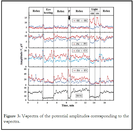 amplitudes