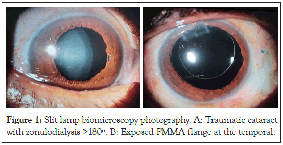 biomicroscopy