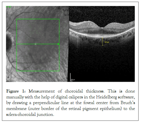 choroidal