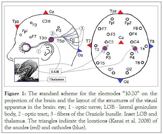 electrodes