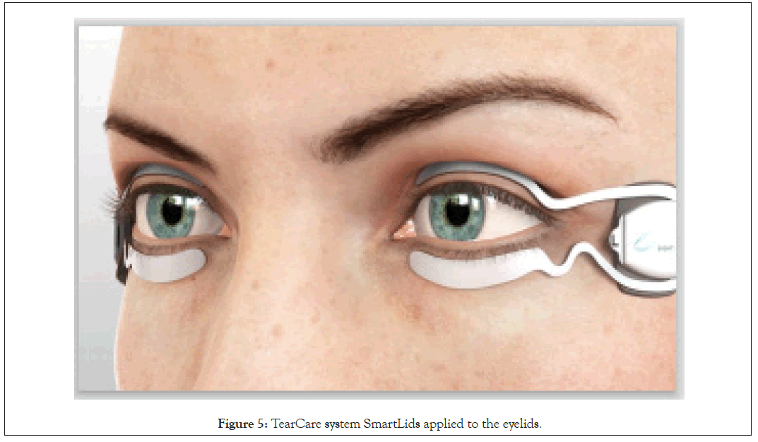 eyelids