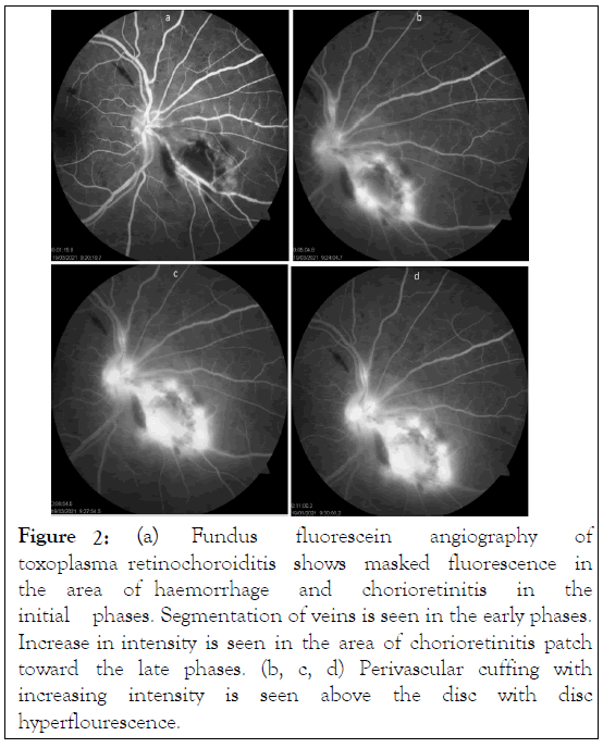 fluorescein