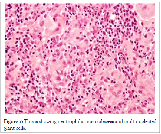 multinucleated