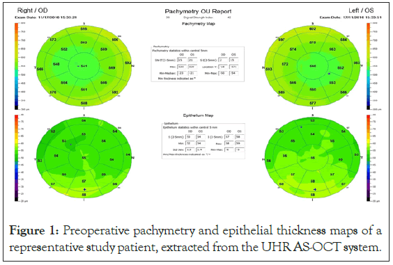 pachymetry