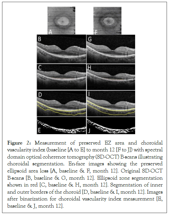 vascularity