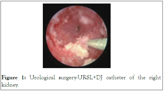 clinical-trials-catheter