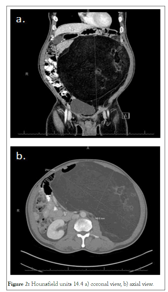 clinical-trials-coronal