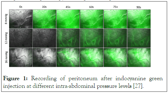 peritoneum