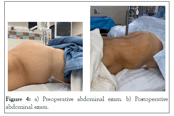 clinical-trials-preoperative