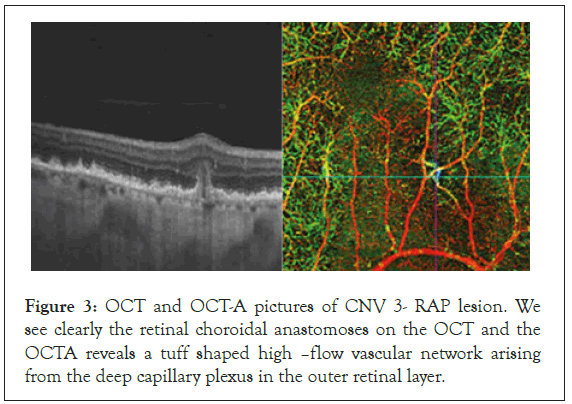 clinical-trials-retinal