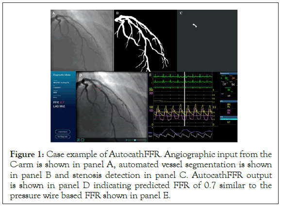 experimental-cardiology-AutocathFFR