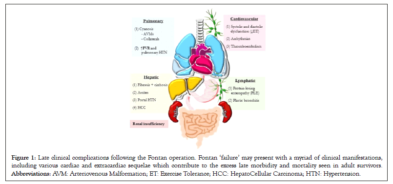 Carcinoma