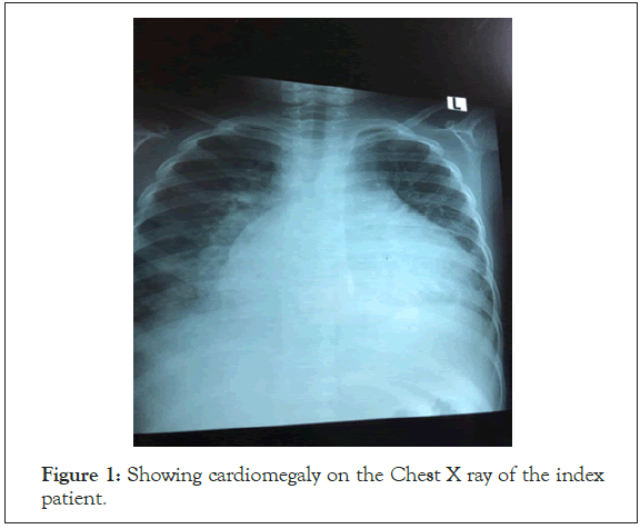 experimental-cardiology-Chest