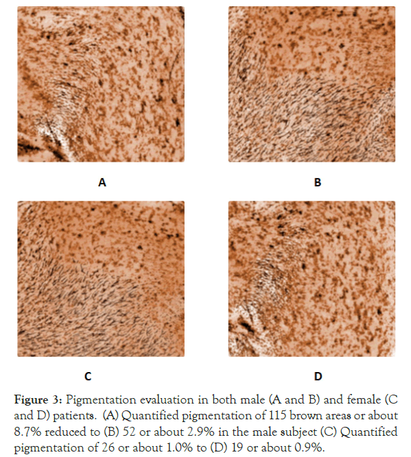 experimental-dermatology-Pigmentation