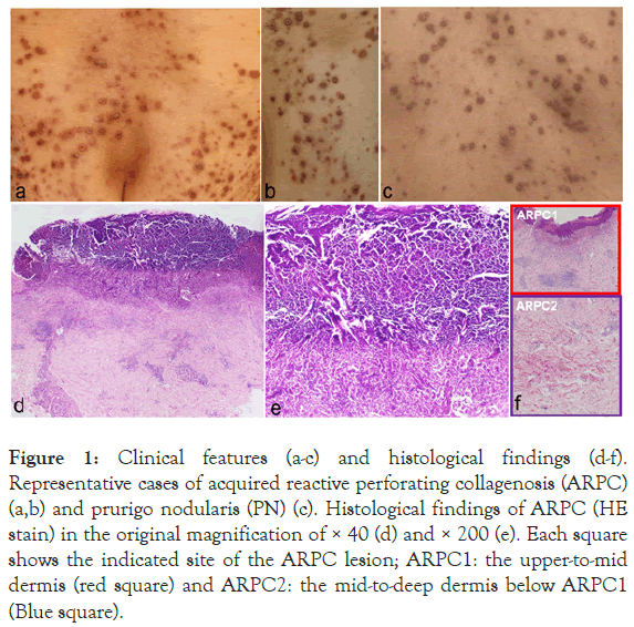 experimental-dermatology-reactive