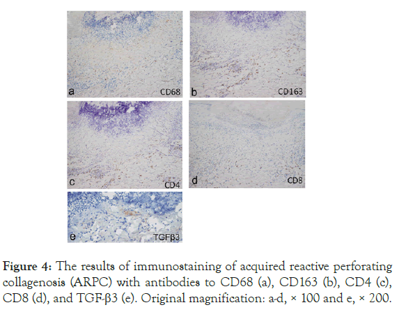 experimental-dermatology-reactive