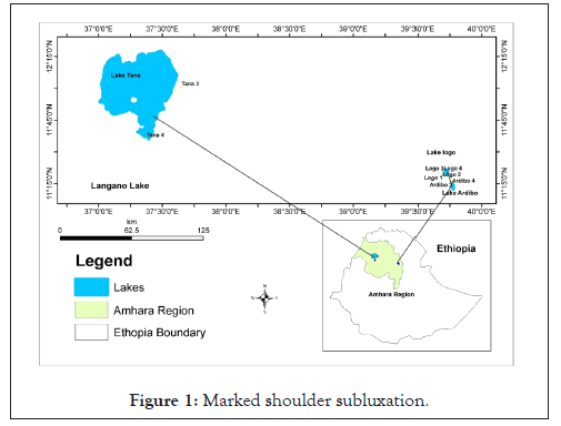 fishery-resources-subluxation