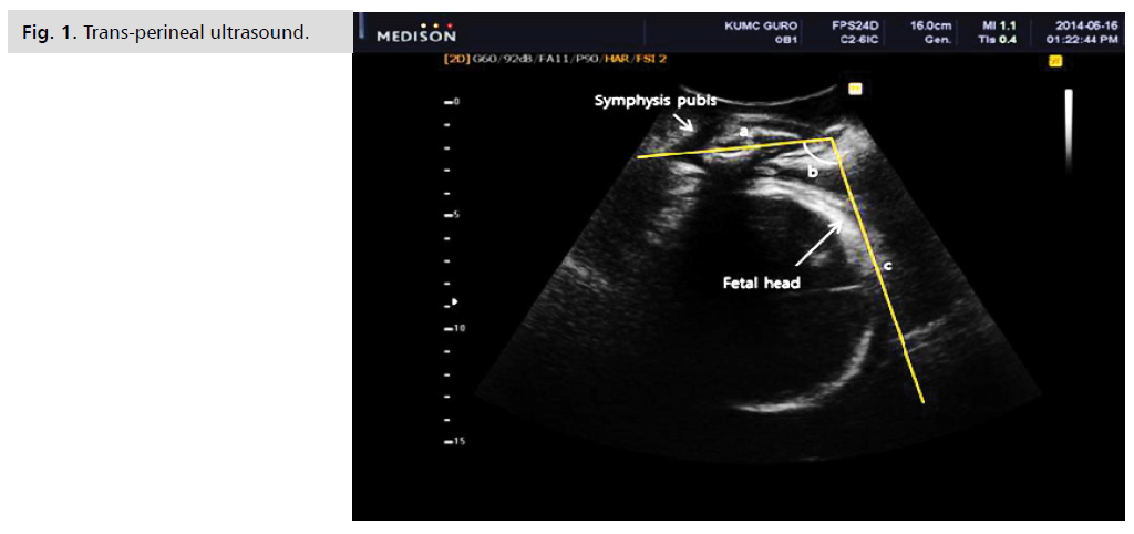 ginekologia-perineal-ultrasound