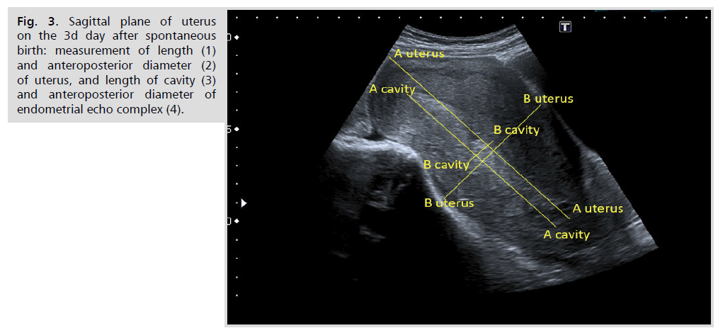 ginekologia-sagittal-plane