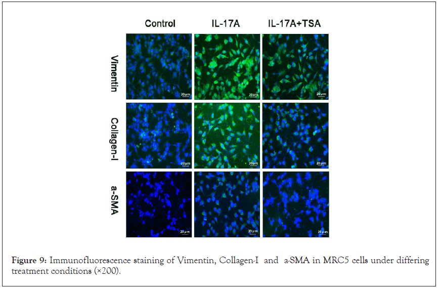 Vimentin