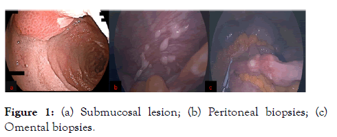 internal-medicine-biopsies