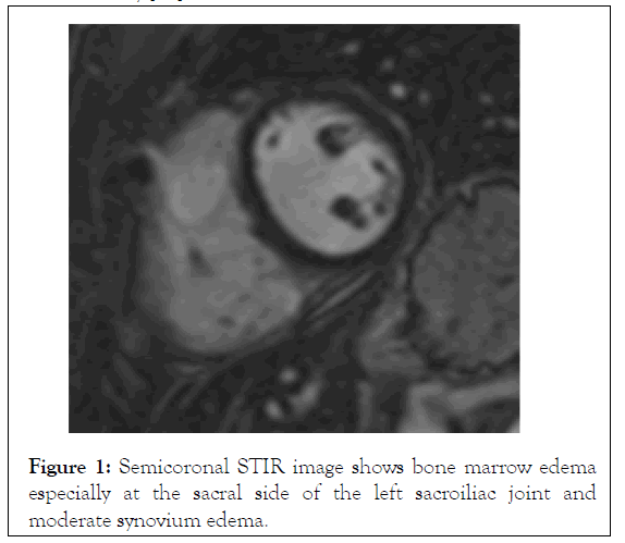 internal-medicine-edema