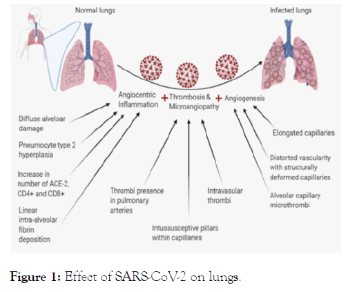internal-medicine-lungs