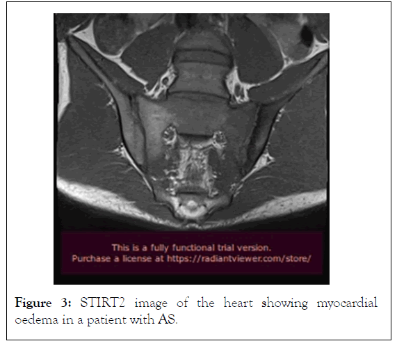 internal-medicine-myocardial