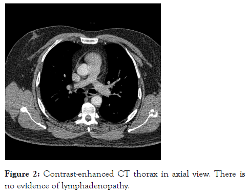 internal-medicine-thorax